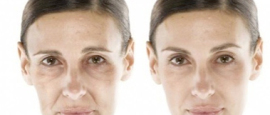 Antiaging Treatments Essex